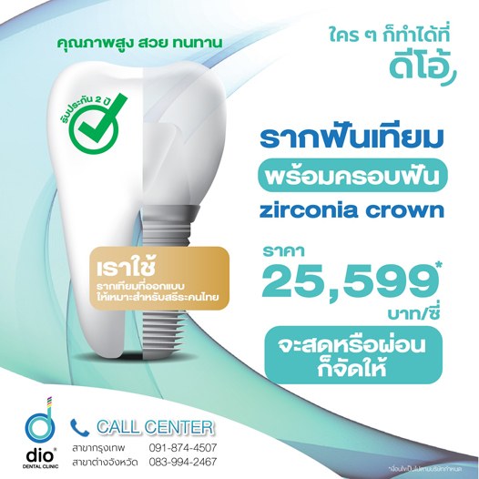 ราคาทำรากฟันเทียม