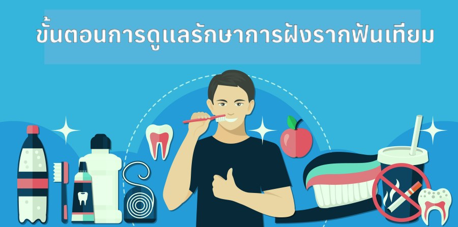 ขั้นตอนการดูแลรักษาการฝังรากฟันเทียมที่เหมาะสม