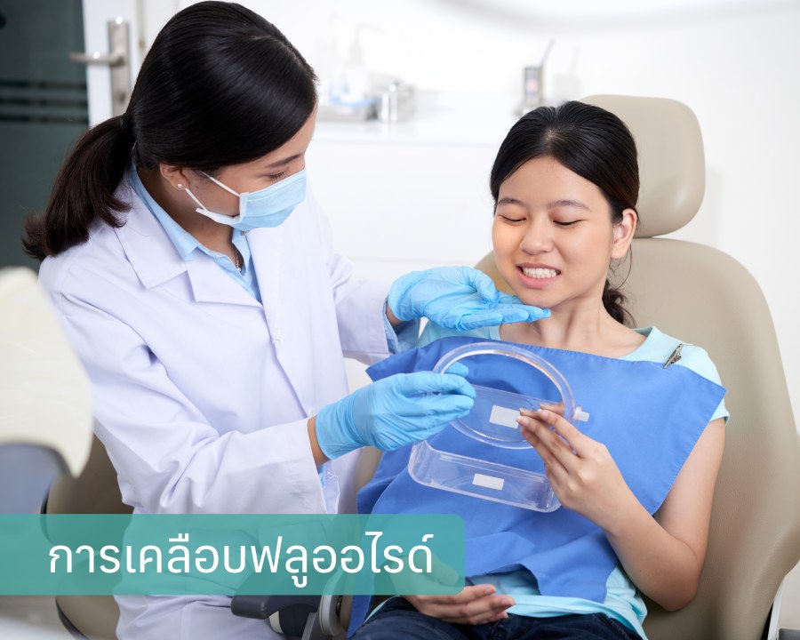 ทำความสะอาดฟัน

เคลือบฟลูออไรด์

รอให้ฟลูออไรด์ทำงาน

ให้คำแนะนำหลังการเคลือบ