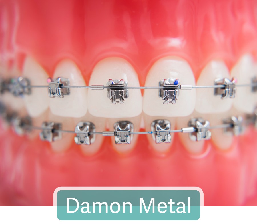 Damon Metal