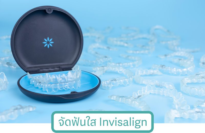 จัดฟันใส invisalign