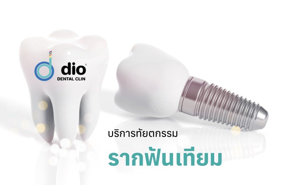 รากฟันเทียม